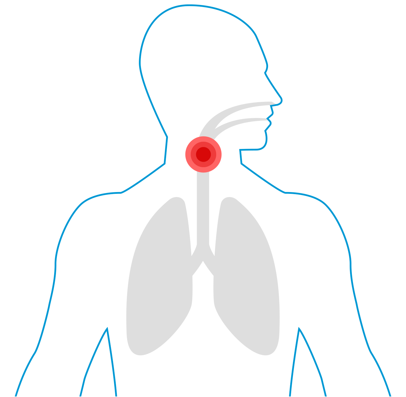 Sore Throat Sore Throat